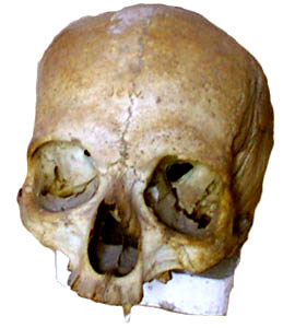 Australoid Skull