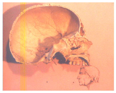 Skull of Man